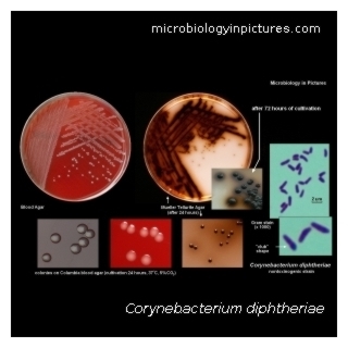 C.diphtheriae
